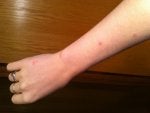 Skin Joint Arm Finger Leg